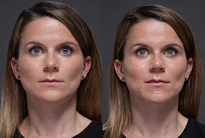 Before After Woman face with blue eyes on grey background | Fillmed