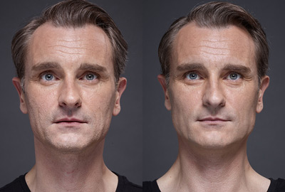 Before After man face | Fillmed