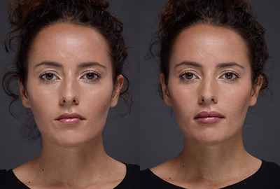 Before After Woman face with brown eyes on grey background | Fillmed