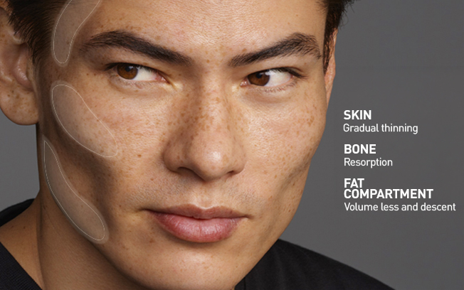 Facial skin sagging