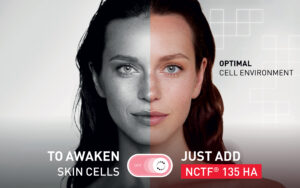 AWAKEN-SKIN-CELLS-WITH-NCTF-135-HA(1)0 Microneedling before and after real results with NCTF 135 HA