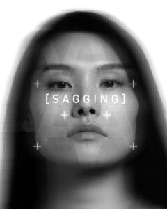 SAGGING Treating wrinkles and skin sagging with a professional chemical peel